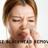 how to remove blackheads on nose