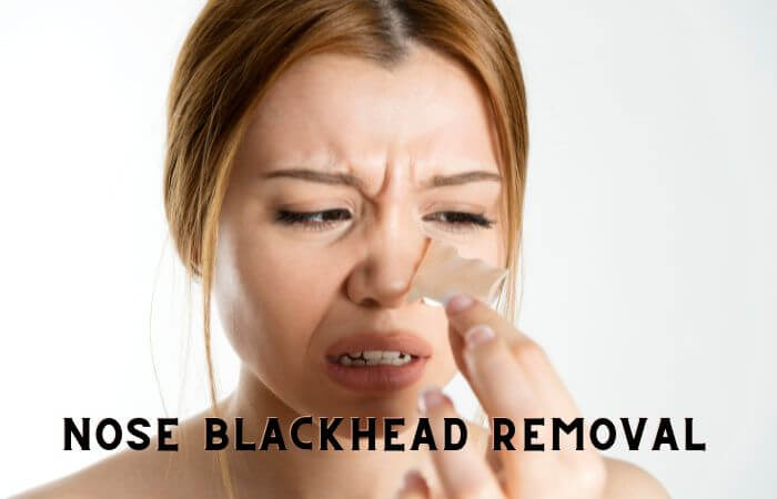 how to remove blackheads on nose