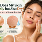 oily but dehydrated skin